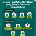 Grafis gejala Hepatitis Akut dari Dinas Kesehatan Muba. (fornews.co/ist)