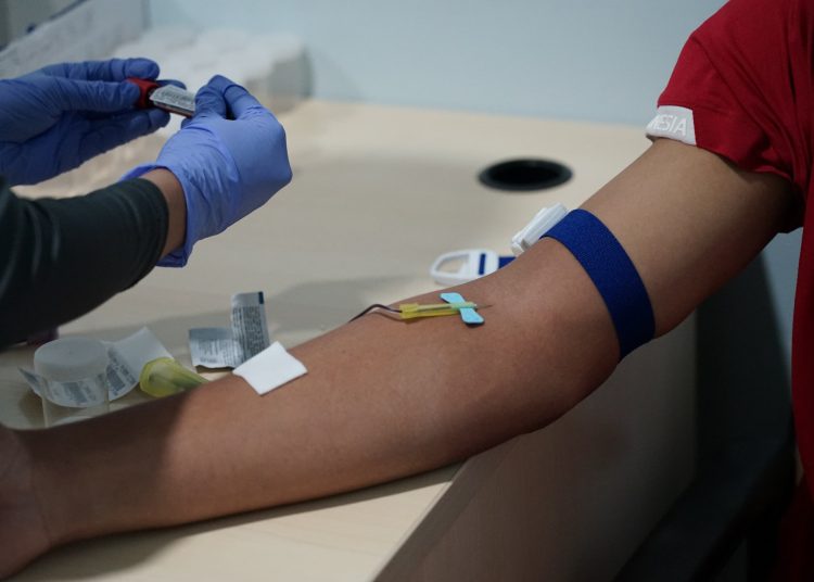 Penampakan tangan dari salah satu pemain Timnas Indonesia U-17 saat menjalani tes Kesehatan di Rumah Sakit Mitra Keluarga Cibubur, Selasa (31/10/2023). (fornews.co/ist)